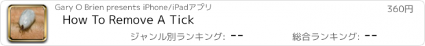 おすすめアプリ How To Remove A Tick